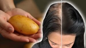 Само 1 картоф и косата расте като полудяла и повече не пада! Най-МОЩНАТА рецепта против косопад и олисяване 22 494377841 690366613739240 4937835663107584341 n