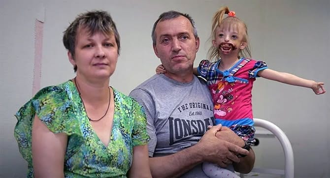 Родена е без челюст и уста, роднините се отказали от нея, защото не можели да я гледат, а това е тя днес: Всички са изумени! 9 495035791 670813982361170 2164898557281655258 n