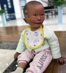 Това момче се роди с необичайно лице и когато майката го видя за първи път, замръзна от ужас... 2 497842444 1114858234019801 897637984860491567 n