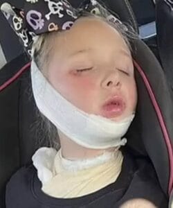 Родители предупреждават за фатална грешка в микровълновата печка, когато 7-годишно момиче получава тежки наранявания и изпада в кома. 38 499623442 122160934574569457 7944576709424101857 n