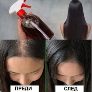 Ефектът е поразителен! Домашен лек против косопад и олисяване - новата коса расте по-гъста, по-лъскава, по-здрава 42 500056164 1092809976203530 7299737787105053869 n
