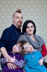 Тези сиамски близначки наскоро навършиха 18 години. Родени са сраснали в областта на главата, с частично слети мозъци. 110 511119179 1143780167794274 89847