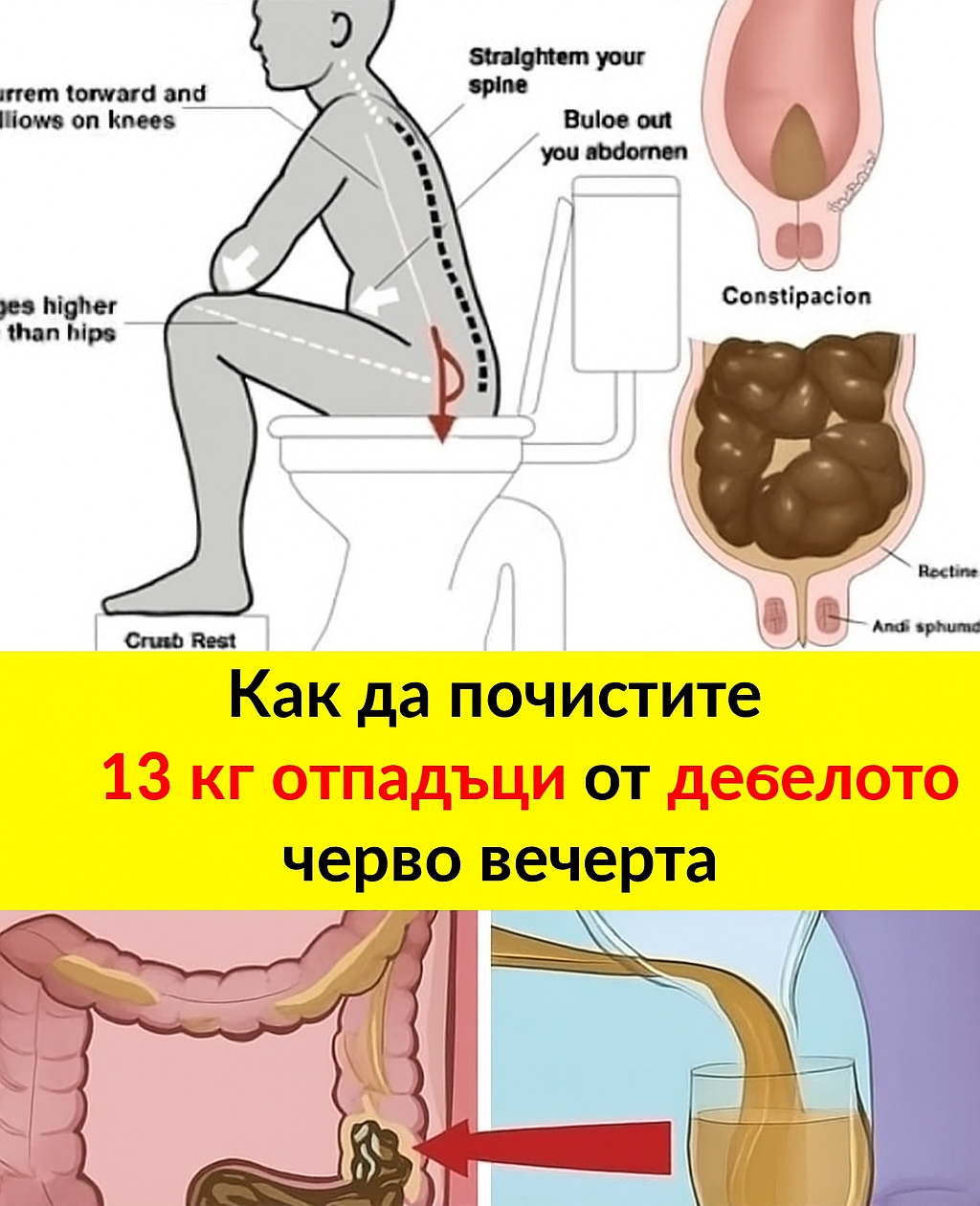 Как да подкрепите здравето на дебелото черво през нощта – нежен и естествен подход 3 0a9e32f9 e41d 4d38 8fa4 19e122e901c2
