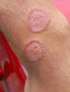 Ако забележите тези белези по кожата си, това е знак, че… 50 518294433 626474533823571 127983