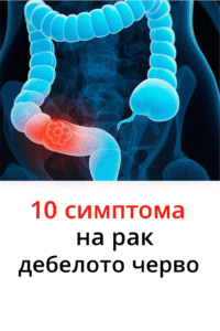 10 признака на рак на червата 20 chatgpt image 10.07.2025 g. 12 57 14