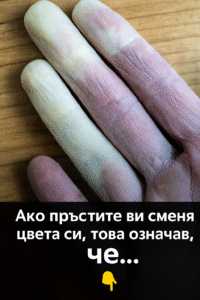 Защо пръстите сменят цвета си? 32 chatgpt image 14.07.2025 g. 23 45 09