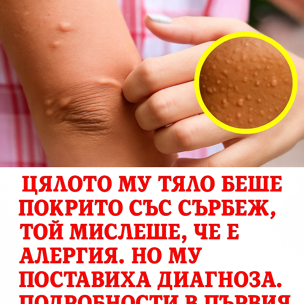 Цялото тяло го измъчваше от силен сърбеж, той предполагаше, че е алергия, но му поставиха диагноза… Повече подробности в коментарите 👇 3 chatgpt image 15.07.2025 g. 23 26 56