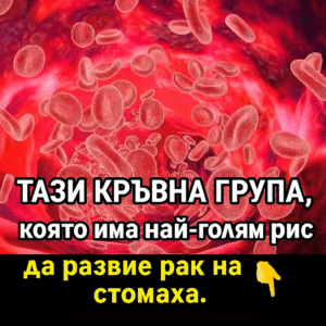 Лекари посочиха коя е кръвната група с най-висок риск от развитие на рак на стомаха. 2 chatgpt image 21.07.2025 g. 15 22 15