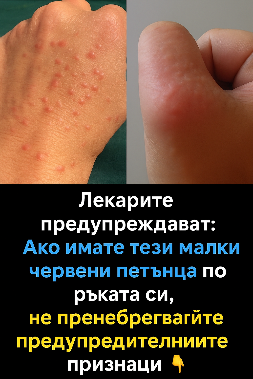 Лекарите предупреждават: ако имате тези малки червени точици по ръката или дланта си, не пренебрегвайте сигналите на тялото 3 chatgpt image 24.07.2025 g. 23 26 09