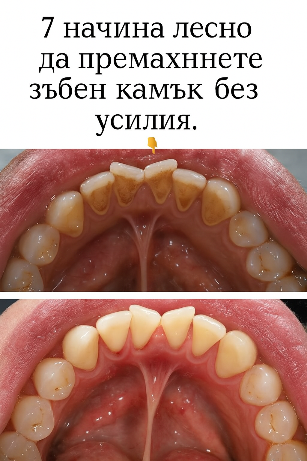 7 начина лесно да премахнете зъбен камък без усилия. 3 chatgpt image 26.07.2025 g. 13 04 54