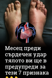 Месец преди сърдечен удар тялото ви ще ви предупреди за тези 7 признака, особено за шестия 😨 50 chatgpt image 8.07.2025 g. 18 13 17